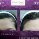 미앤미헤어라인