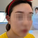 주향교회 | 광주피부관리 ▶인셀덤 주향점 무료체험 후기