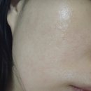 바다포도 모공앰플 후기 vs 다이소템 차이 사용방법 전후사진