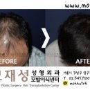모재성성형외과의원 이미지