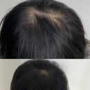 햇빛헤어라인 - 북구 | 햇빛헤어라인