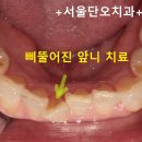 단대오거리 1번출구 앞 이미지
