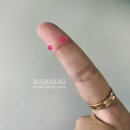 윤성열내과의원 | 청주 파상풍 예방접종 후기 :: 길고양이한테 물린 김에 시원하게 10년짜리 파상풍 예방 접종 함