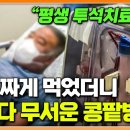 자극적인 음식만 먹다가 찾아온 만성콩팥병 이미지