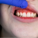 365 엠아이(MI) 치과의원 | 부드럽지만 깔끔하게, 새로운 칫솔 습관의 시작