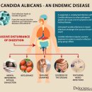 칸디다를 잡으면 많은 질병을 잡을 수 있다 / 칸디다는 어떻게 잡지? 이미지
