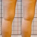 신림홈마트 | 신림 신부관리 라임뷰티 바디슬리밍 여름대비 하체관리 솔직후기
