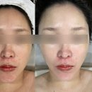 창원여드름 피부관리 쉼에스테틱 후기