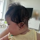 안일전자 | 두상교정 기록 (1) 사두 의심과 지오헬멧 인천센터 방문, 헬멧 제작 후기 (사두, 단두, 상동역 지오헬멧)