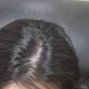 수원-0210 | 수원 팔달구 줄기세포 엑소좀 두피케어 'SMP스튜디오' 1회차 후기