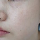 엔카 | 번들거리는 피부 케어 엔카 피지조절앰플 후기