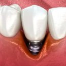 면목동-237 이미지