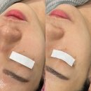 보노뷰티 | 부천 피부관리 재생 보노필 써니뷰티 방문후기