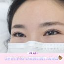 메디타워 | 잠실역속눈썹펌 SHE IN US 한국메디뷰티 이물감없는 속눈썹연장 솔직후기
