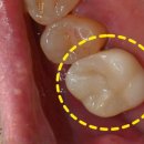 정도치과기공소 이미지