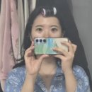 한티하나약국 | 쌍수 인아웃라인 절개 +눈매교정+앞트임 수술 7일차 ~ 한달차 후기