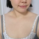 라인 - 광산구 | 창원피부과 디스포트 승모근 보톡스 내돈내산 어깨라인 솔직 후기
