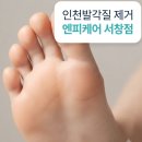 엔피케어 - 중구 종가6길 4-5 | 인천발각질 제거 엔피케어 여름 발관리 후기