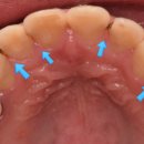 란치과기공소 이미지