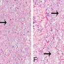 더왈츠의원 | 더왈츠의원 힐로웨이브 HILOWAVE 런칭 기념 이벤트♥ (~10/25)