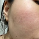 타토아의원 용인점 이미지