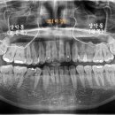더바른윤치과의원 이미지