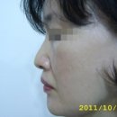 웰빙비뇨기과 네이버블로그