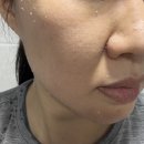 필PC | 뉴이시스 트라넥삼산 필 세럼, 자극없이 잡티필링 솔직사용후기