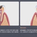 튼튼잇몸치과의원 이미지