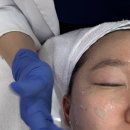 하임약국 | 인천 구월동 피부관리 프레야 리메플라윤곽 후기 추천