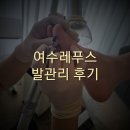 레푸스여수웅천점 | 여수 레푸스 각질관리 내성발톱 무좀 전문적인 발전문 샵에서 관리받고 왔어요