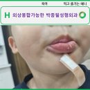 박종필성형외과의원 | 아산 봉합수술이 가능한 성형외과 , 박종필 성형외과