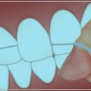 365효플란트치과의원 이미지