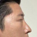 윤성호치과의원 | "이미 꽉 찼어요"…수능 아직인데, 성형외과 문의는 '북새통'