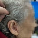 상계독일보청기 이미지