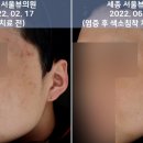서울뷰의원 네이버블로그