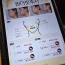 두두핏 | 강남역성형외과 원더핏주사(지방분해주사) 3회차 후기