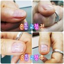 네일 정은
