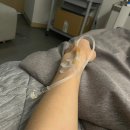 잠실연세이비인후과의원 | 잠실 하나이비인후과 부비동염, 물혹 제거 수술 후기