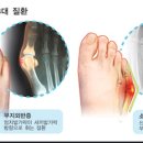 오리궁뎅이 이미지