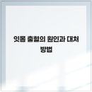 잇몸 출혈의 원인과 대처 방법