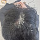 도원힐링스파 | 용인 성복역 미용실 이오헤어앤스파 커트 맛집｜두피클리닉 후기