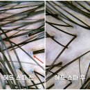 윤국희 | 명지 두피 관리 머리에 각질이... 슈가윤뷰티