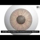 장원온누리약국 | 스마일라식 했어요