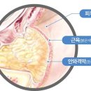 그리다성형외과의원 | [그리다 성형외과] 피곤해 보이는 인상 바꾸는 눈밑지방재배치 효과와 특징
