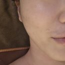 좋은 차 만들기 가양점 | [서울/강서구] 강서구 윤곽관리 리프리아 에스테틱 작은얼굴만들기 피부관리