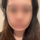 수미인 - 성동구 | 금천구에스테텍 수미인 윤곽관리 후기 효과