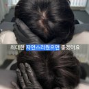남성생활교육 | 광주정수리두피문신, 40대 남성분의 실제 작업 후기