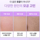 이토록뷰티 | 무신사 뷰티 1위 대란템! 약국에서 난리 난 힐릭 클리어 모공가지앰플 솔직 후기 (ft. 레티날+가지 성분)