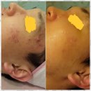 반석피부관리 피부천사 노은점에서 달라진 나의 피부와 몸